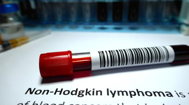Non-Hodgkin Lymphoma Awareness: Spreading Knowledge and Support