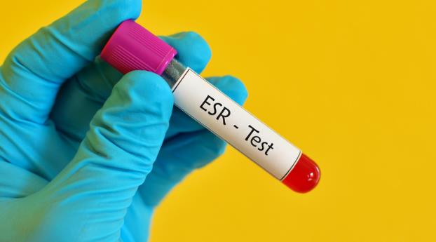 What is the ESR Level in Cancer Patients?